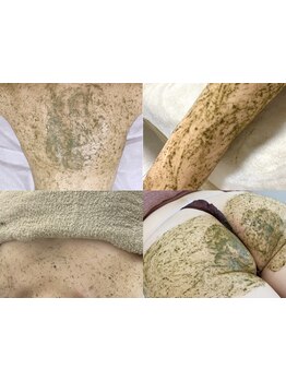 お肌をきれいにしたい