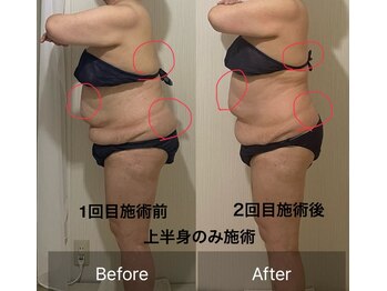 ウツク(utuku)/上半身BODYメイク　長岡/痩身