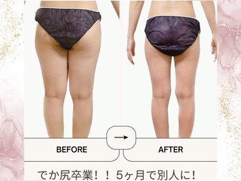 ウェリナポノビューティサロン(welina pono beauty salon)/《痩身/ダイエット/小顔》