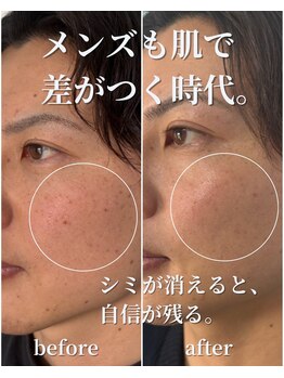 セリー(Celie)/お客様症例