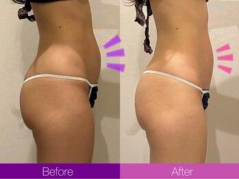 クレヴィア バイ サイバーエステ(CREBIA)/【お腹周り集中】90分