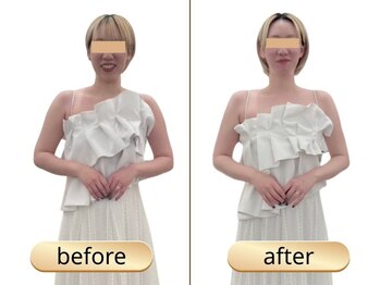 ブライダルエステ バイ スイスパ表参道(BRIDAL ESTHE by SUI SPA)/【痩身】ボディBefore→After