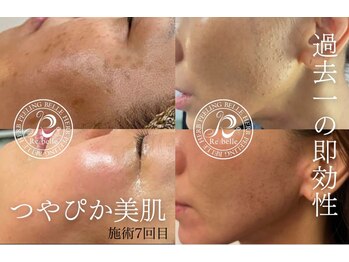 クリア 麻布十番(CLEAR)