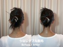 メローワックス 横浜店(MELLOW WAX)/【横浜駅/脱毛/ワックス/光】