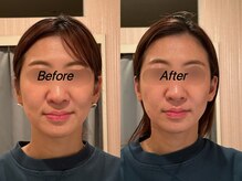 薬手名家 心斎橋店/お客様ビフォーアフター