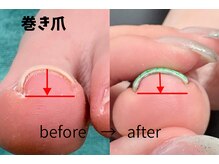 エン(en.)の雰囲気（歩くたびの違和感に。やさしい巻き爪ケア。ご相談もお気軽に♪）