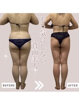 ソワン(Soin)/全身　１０回