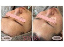 ストーリー(STORY)/眉毛と艶肌ワックス専門店