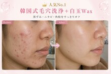 毛穴専科