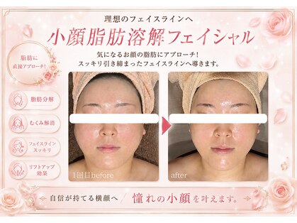 エステティックサロン フェアリー(ESTHETIC SALON FAIRLY)の写真