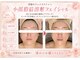 エステティックサロン フェアリー(ESTHETIC SALON FAIRLY)の写真