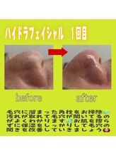 ワイズ(Y’s)/ハイドラフェイシャル☆