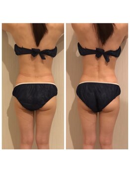 アンリール 帯広店/