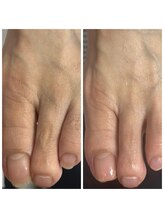 ドクターネイル爪革命 十条店/爪ケア