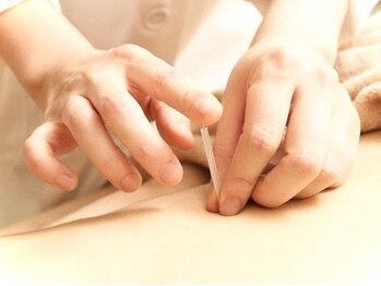 鍼灸院シマダ 宇多津(鍼灸院SHIMADA)の写真/【腰痛専門の鍼灸院】