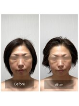 コンジュ(kongju)/コルギ