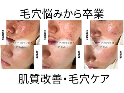 ポアレ 高崎店(POALE)の写真