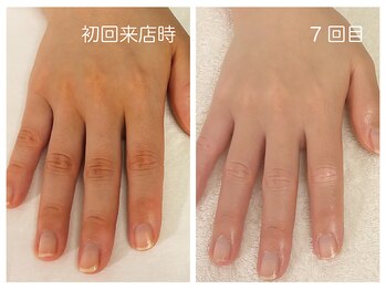 キレイテ 福岡天神店/40代/7回目【大名ハンドケア】