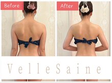 ヴェルセーヌ(VelleSaine)/肩甲骨の内側の厚みを薄く★