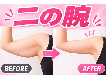 ヨサパーク アンジュ 千早店(YOSA PARK Ange)の写真/自分では落としづらい二の腕や背中のハミ肉はプロにお任せ◎ルルオンとリンパケアで脂肪を柔らかくして分解