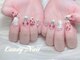 キャンディーネイル(candy nail)の写真