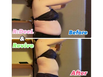 デール(R:DeeL)/ぽっこりお腹をスッキリしましょ