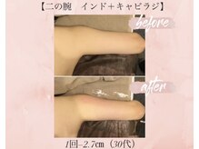 オキシー グレイス 小倉店(OXY Grace)/30代お客様ビフォーアフター