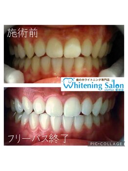 シフォン 豊田店/3週間フリーパスコース