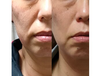 シエスタ 新小岩/徹底引き上げ！！