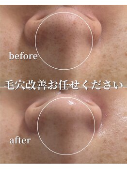 セリー(Celie)/お客様症例