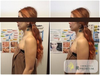 美プレミアム 越谷店/360°美顔小顔矯正｜施術結果