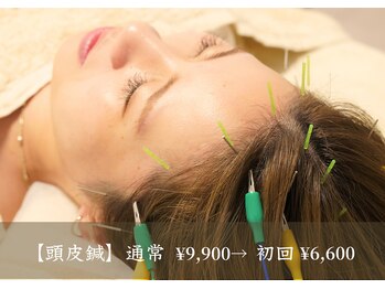 アモ(amo)/頭皮鍼