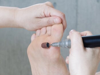 プリンセス アール(Princess R)/ドイツ式角質ケアオススメです。