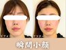 【瞬間小顔】最短で小顔になりたい方はコチラがオススメ☆即効性重視☆