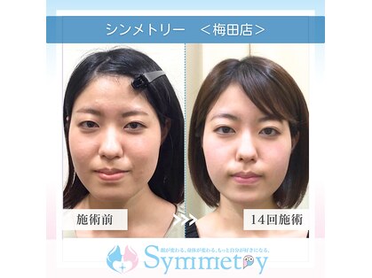 小顔矯正専門店 シンメトリー 梅田の写真