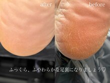 サロン ド ネイル 椿(Salon de nail 椿)/韓国式角質ケア