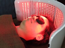 キュライム 熊本(CURAIM)/育毛促進【施術中の様子】