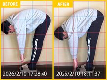 整体院 元 光の森店/野球の練習による肩の悩み