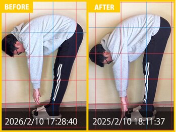 整体院 元 光の森店/野球の練習による肩の悩み