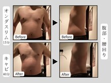 クローネ(Krone)/オンダスリム・キャビ　B/A