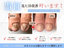 ブルームーンネイルズ(BLOOMOON.nails)