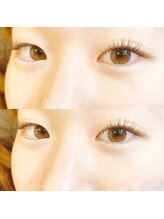 ビューティーホスピタル(Beauty Hospital)/ダークモカカラー