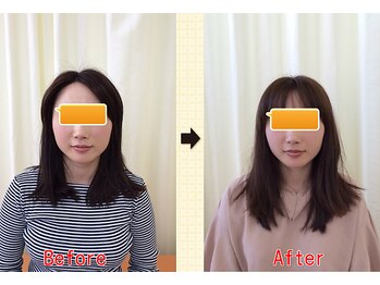 なぎ整体院/小顔矯正ビフォーアフター