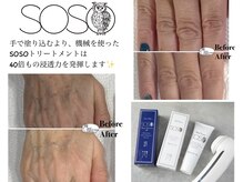 肌の奥へ針を使わない美容導入-高純度美容成分で美しい手元に☆