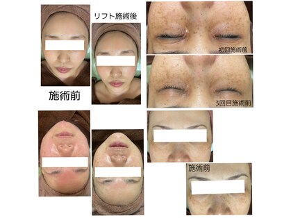 カヌヌ(Kanunu)の写真