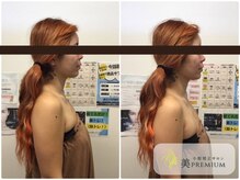 美プレミアム 越谷店/360°美顔小顔矯正｜施術結果