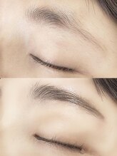 アテナ(ATENA)/ハリウッドブロウリフト