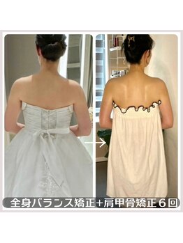 ソウ バイ ソウ(So by 蒼)/激変6回!ブライダルエステ整体