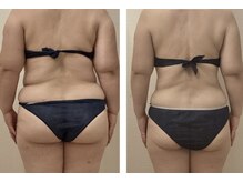 リ オアシス(Re:Oasis)/痩身120分×9ヶ月