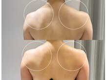 アンベリール(Embellir)/話題の神の手マシーン